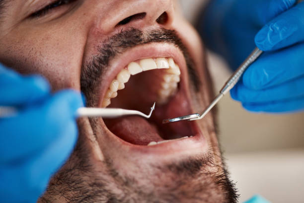 Best Laser Dentistry  in Davison, MI